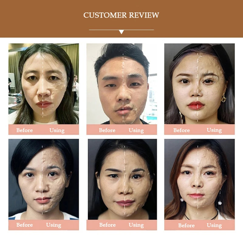 3D Hifu Hanacure Mask Facial Mask Therapy V Face Facial Lift Anti-aging Reducing Pores Fade Fine Line Korean Cosmetics