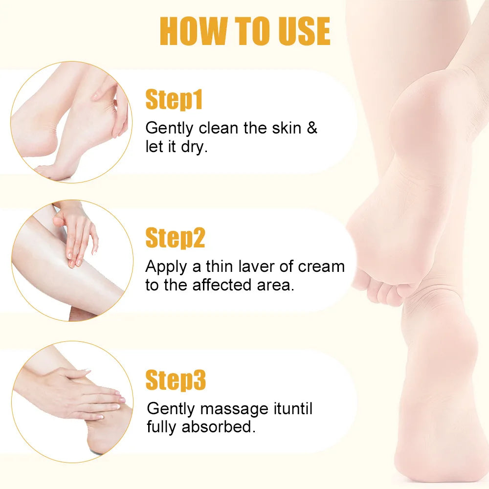 40g Urea Foot Cream Dry Cracked Feet Heel Gentle Exfoliation Softening Skin Ultra-Hydrating Hand Foot Care Cream Stick Protuct