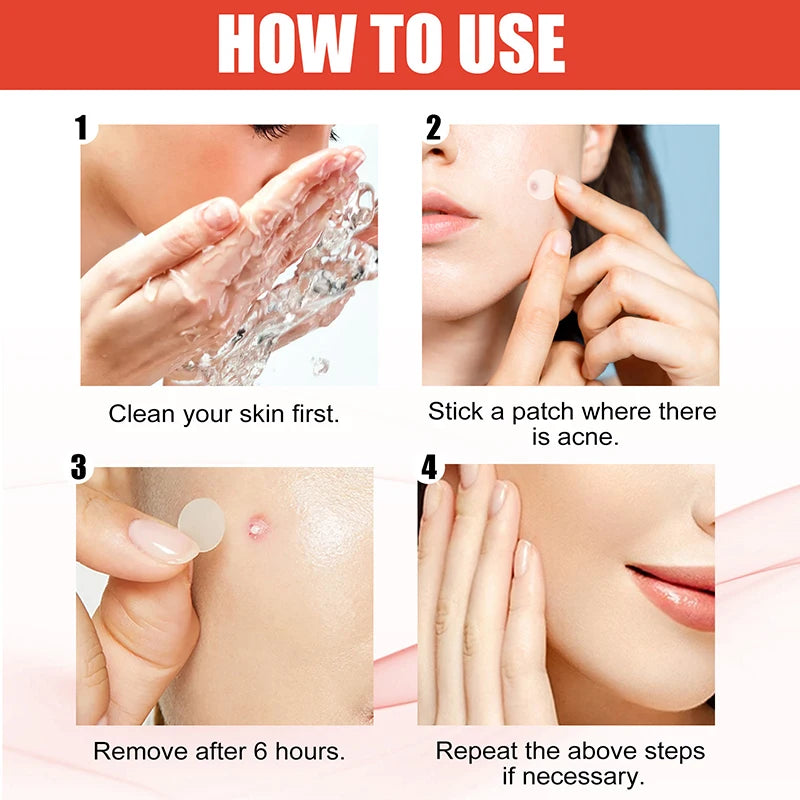 720PCS Circular Transparent And Skin Tone Acne Patches Skincare Stickers Facial Spot Covering Makeup Tools