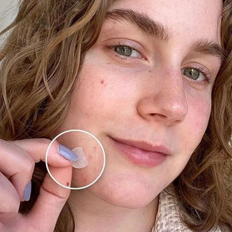 720PCS Circular Transparent And Skin Tone Acne Patches Skincare Stickers Facial Spot Covering Makeup Tools