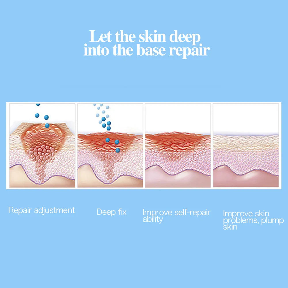3D Hifu Hanacure Mask Facial Mask Therapy V Face Facial Lift Anti-aging Reducing Pores Fade Fine Line Korean Cosmetics