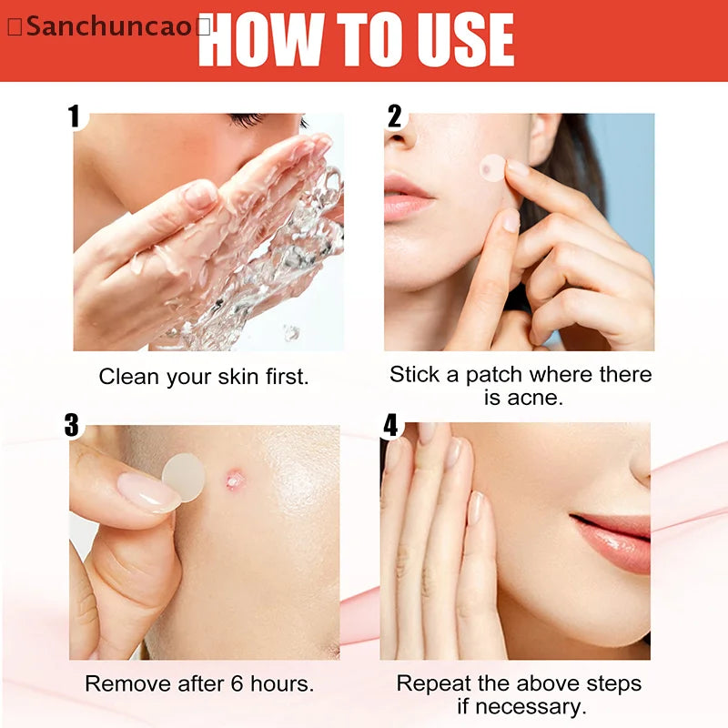 720PCS Circular Transparent And Skin Tone Acne Patches Skincare Stickers Facial Spot Covering Makeup Tools