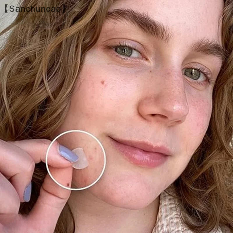 720PCS Circular Transparent And Skin Tone Acne Patches Skincare Stickers Facial Spot Covering Makeup Tools