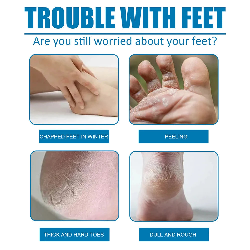 1 Pair Exfoliating Callus Booties Feet Care Foot Mask Sheet Pack Mildly Nourish Moisturizing for Dry Cracked Feet